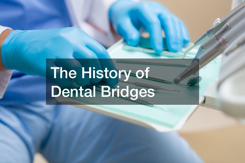 dental bridges