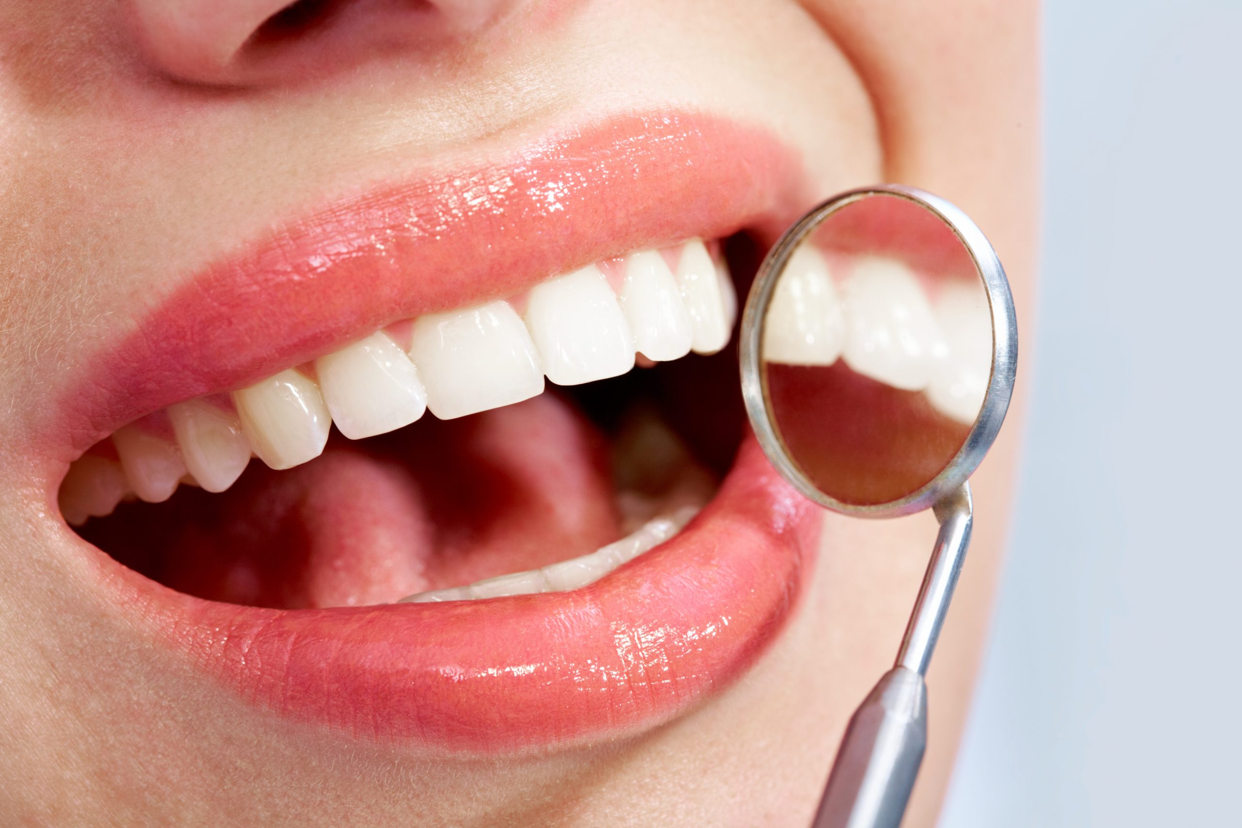 3 Reasons Why Implants Are Important for Your Oral Health