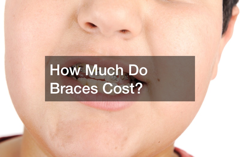 How Much Do Braces Cost?