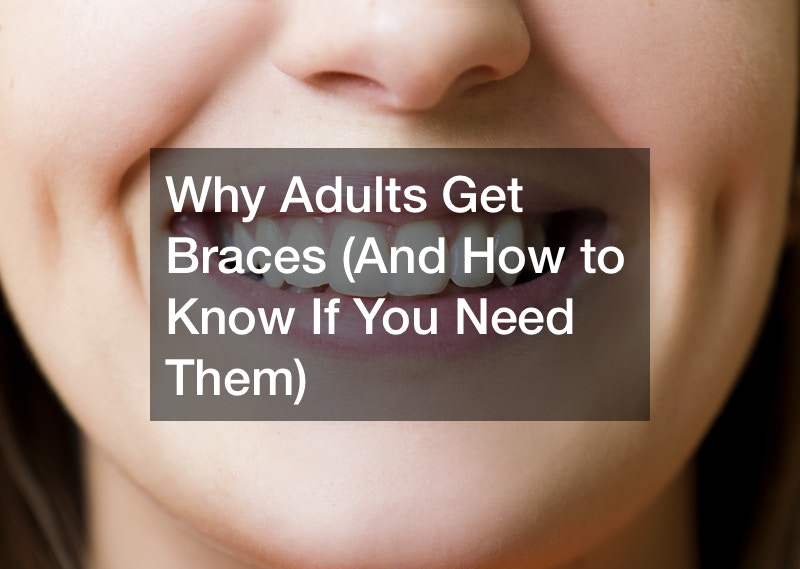 Why Adults Get Braces (And How to Know If You Need Them)