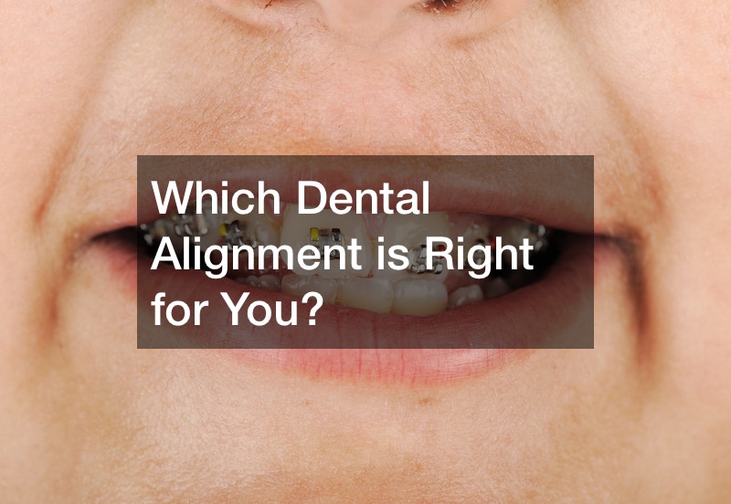 Which Dental Alignment is Right for You?