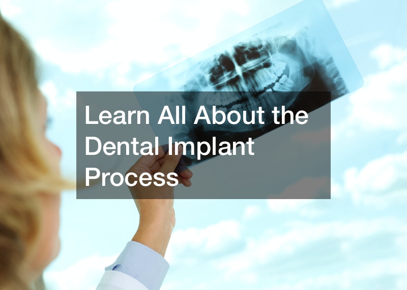 Learn All About the Dental Implant Process