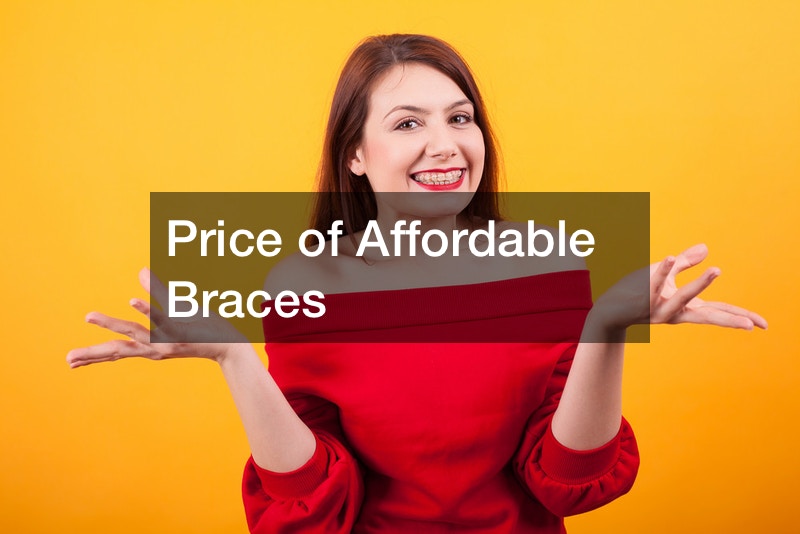 Price of Affordable Braces