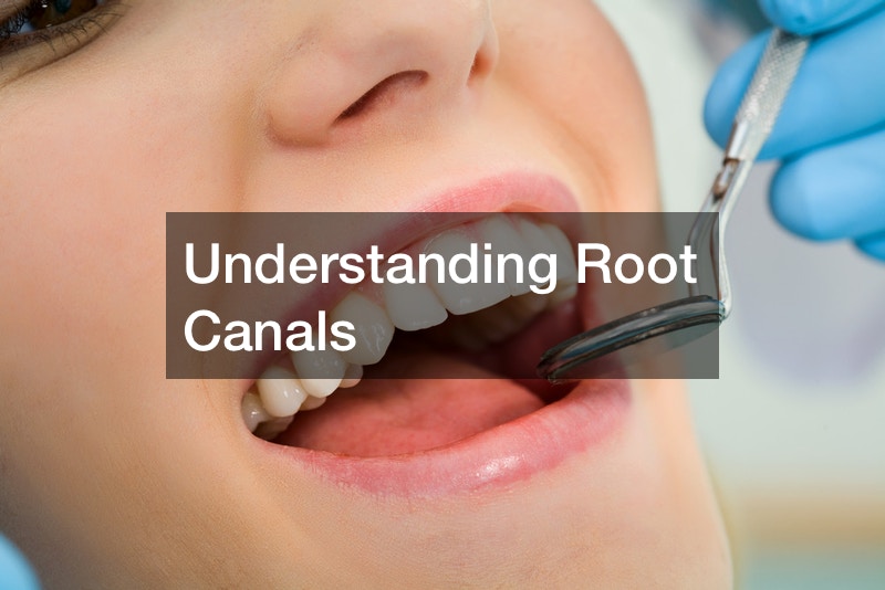 Understanding Root Canals