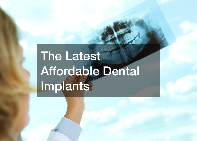 The Latest Affordable Dental Implants