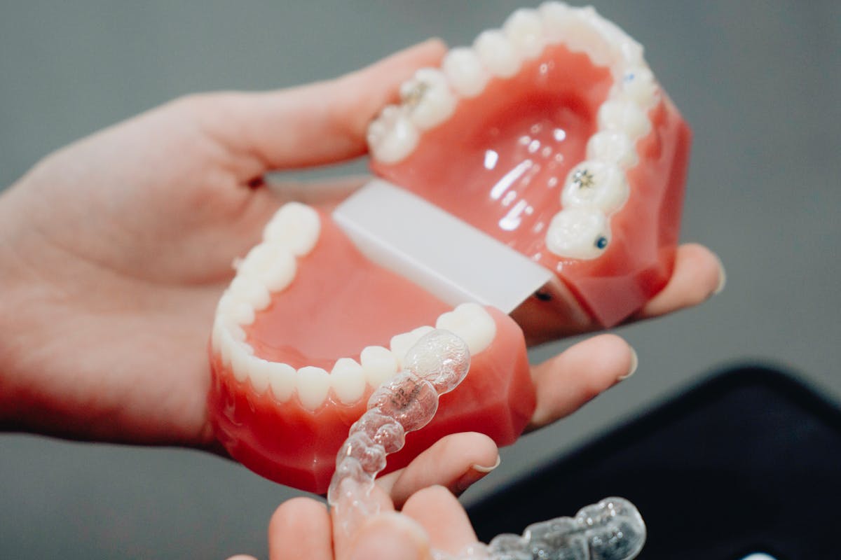 Invisalign Clapham: Personalised Orthodontics for Modern Lifestyles