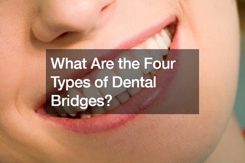 What Are the Four Types of Dental Bridges?