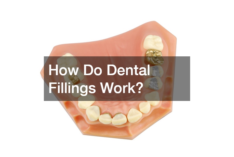How Do Dental Fillings Work?